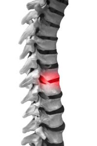 Pain Management Salt Lake City Utah Spinal Disc Problems